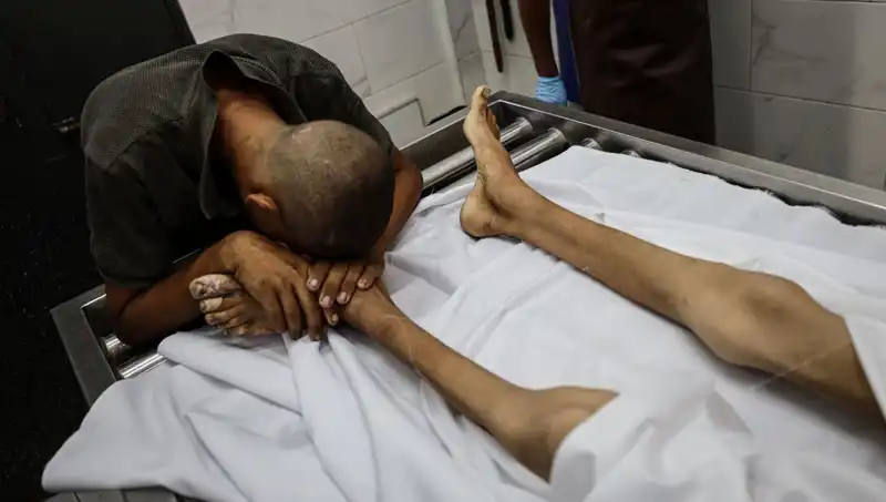 Gazze'de Açlık Tasası: Küçük Bir Hayat Daha Kaybedildi