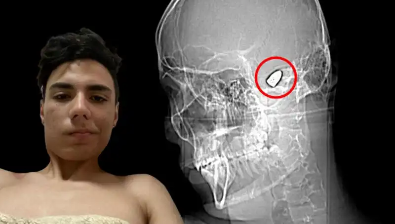 İçsel Çatışmalar: Kafasında Patlayıcı Bulunduran İnsanların Hikayesi